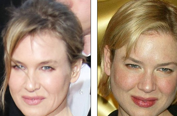 http://www.dailymail.co.uk/tvshowbiz/article-2284124/Oscars-2013-What-happened-Renee-Zellweger--Botox-overdose-Academy-Awards-viewers-startled-stars-youthful-look.html