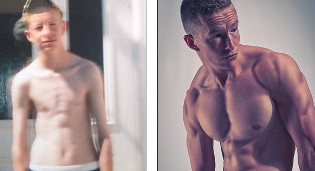 http://www.dailymail.co.uk/femail/article-2417510/Anorexic-boy-beats-eating-disorder-bodybuilder-beefy-pack.html