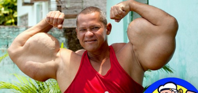 http://www.dailymail.co.uk/news/article-2577998/Real-life-Popeye-doesnt-eat-spinach-injects-potentially-lethal-cocktail-oil-ALCOHOL-grow-monster-arms.html
