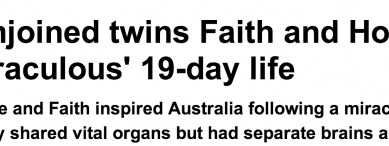 http://www.dailymail.co.uk/news/article-2640215/Conjoined-twins-Faith-Hope-die-miraculous-19-day-life.html
