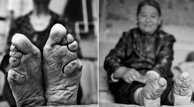 http://www.dailymail.co.uk/news/article-2652228/PICTURED-The-living-Chinese-women-bound-feet-100-years-centuries-old-symbol-beauty-status-banned.html