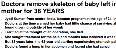 http://www.dailymail.co.uk/health/article-2729720/Doctors-remove-skeleton-baby-left-inside-mother-38-YEARS.html
